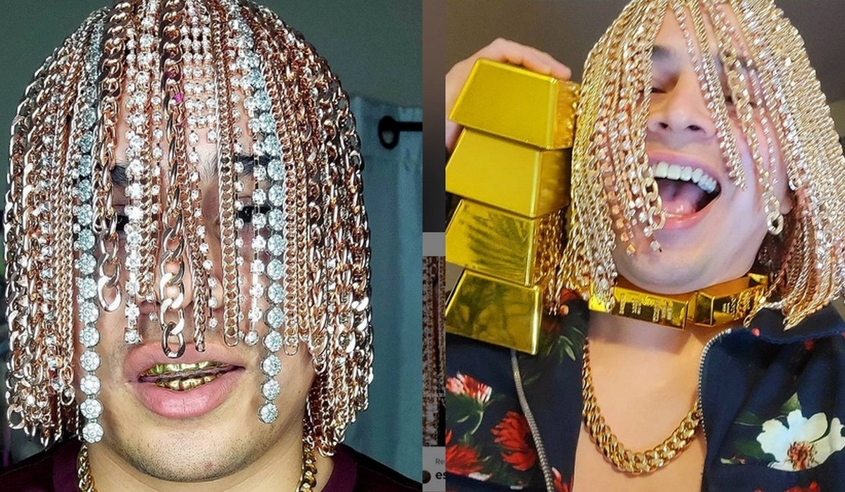 Raper Dan Sur zainwestował w siebie i wszczepił sobie złote łańcuszki zamiast włosów
