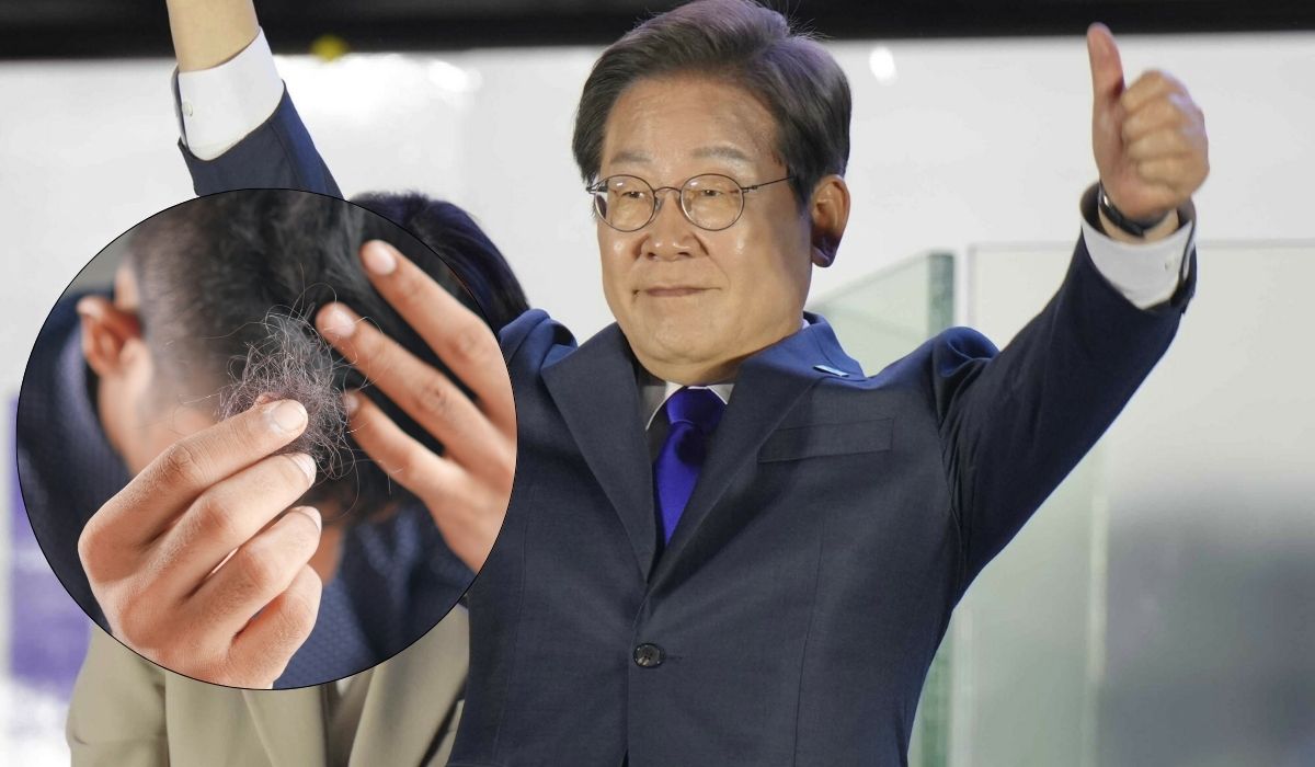 Korea Płd. dyskutuje, czy leczenie łysienia powinno być częścią ochrony zdrowia