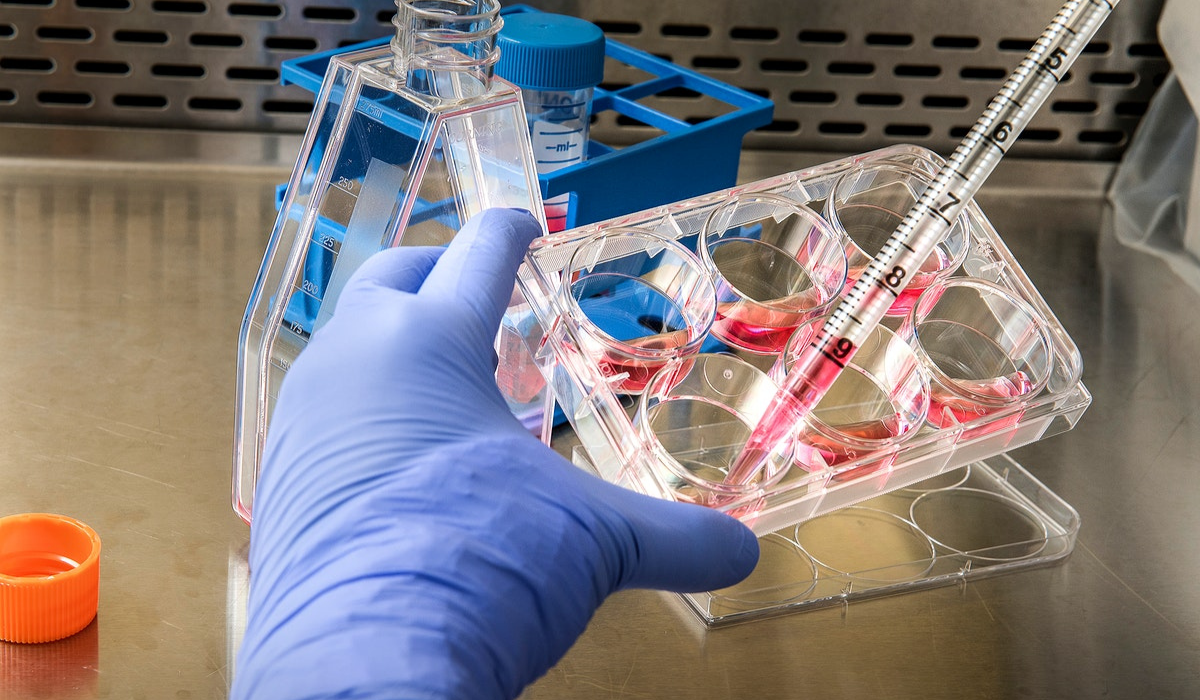 Belgia jako pierwsza na świecie wprowadza kwarantannę dla zarażonych małpią ospą