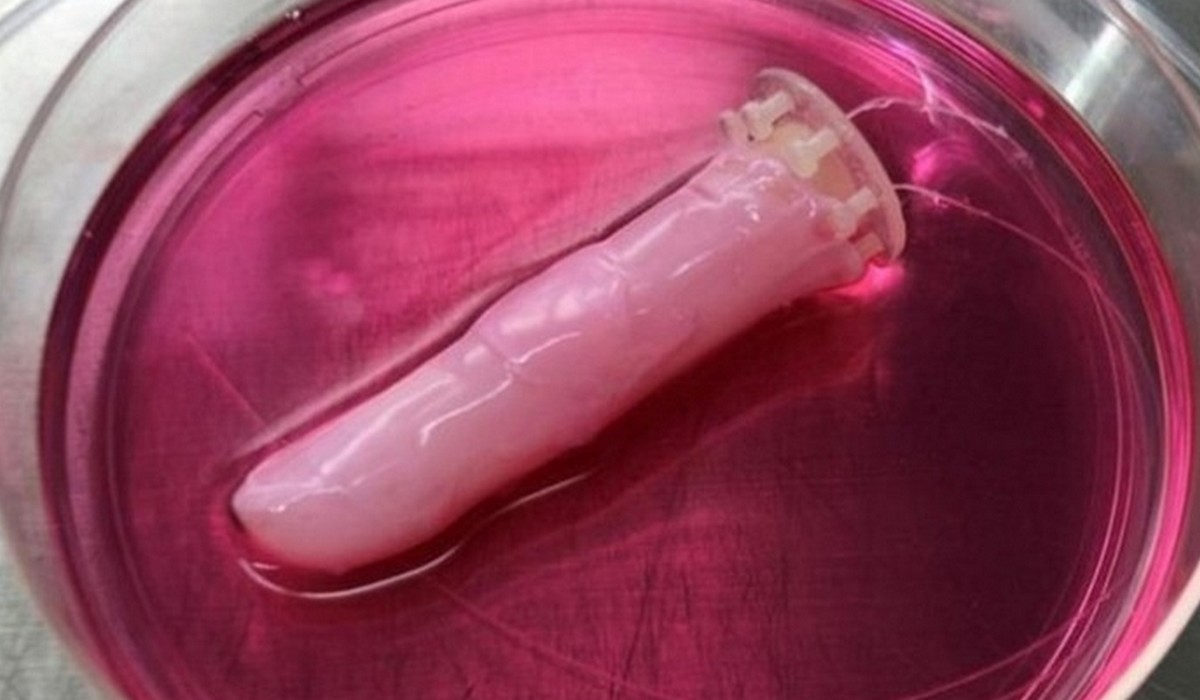 Tokio: naukowcy chwalą się sztucznym palcem ze sztuczną skórą, który chociaż obleśny, może być przełomem