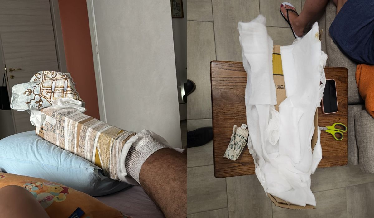 Włochy żyją skandalem po tym, jak pacjent szpitala dostał karton zamiast szyny ortopedycznej