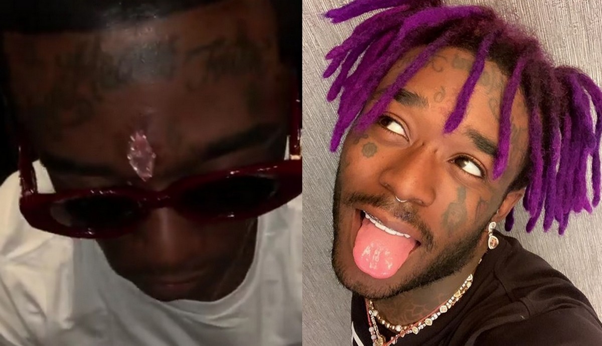 Raper Uzi Vert przesunął granice szpanu i wszczepił sobie diament w czoło