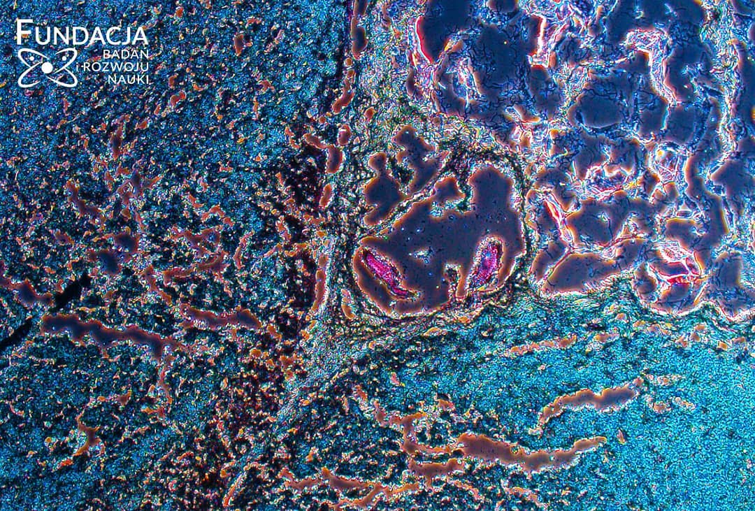 Polacy wydrukowali pierwszą na świecie unaczynioną bioniczną trzustkę  