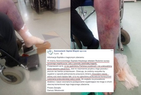 Szpital w Sosnowcu odpowiada: "przepraszamy, że nie spełniliśmy Państwa oczekiwań i nie uratowaliśmy życia naszemu pacjentowi"