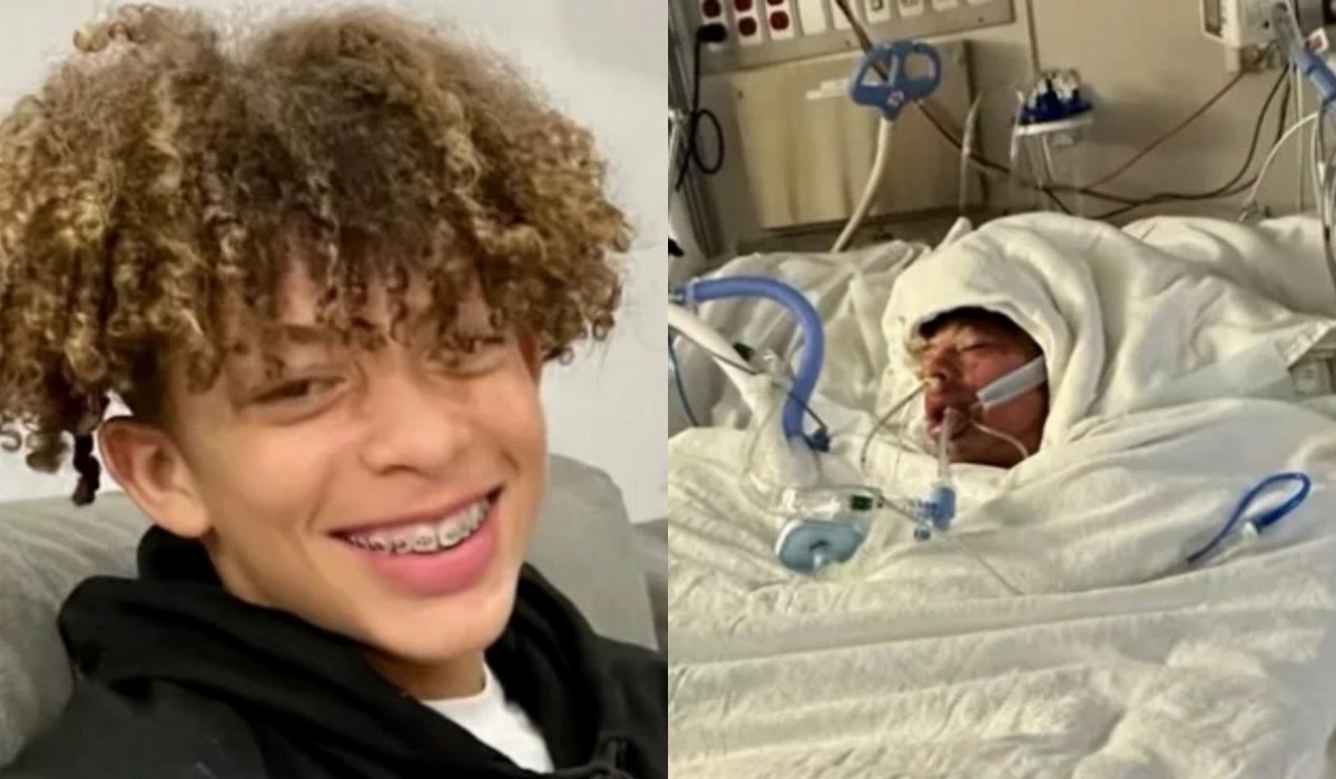 TikTokerowi źle poszło wyzwanie z "pochodnią", skończył z poparzeniami 75% ciała