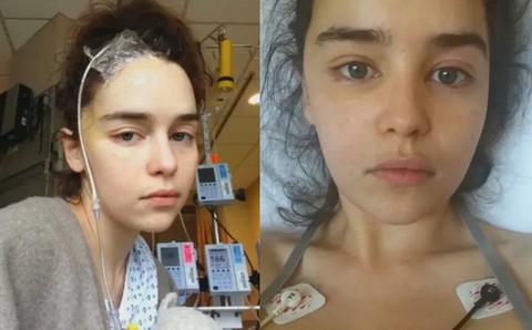 Emilia Clarke opowiedziała o chorobie i ciężkich chwilach w szpitalu
