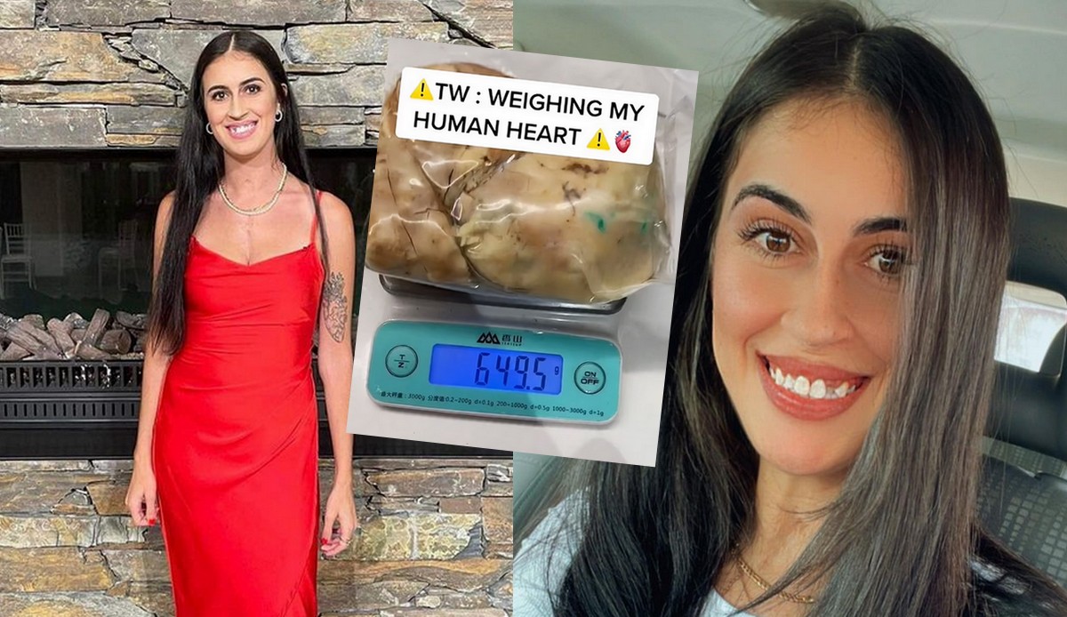 Nowa Zelandia: pracownicy lotniska zatrzymali kobietę z sercem w walizce, okazało się, że to jej własne, używane