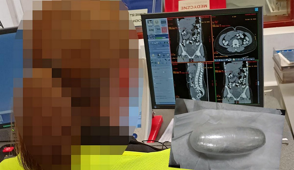 Warszawa: kobiecie udało się połknąć prawie kilogram kokainy, resztę trzymała w plecaku