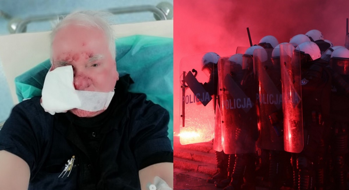 Podczas Marszu Niepodległości postrzelono fotoreportera. Policja: jest nam przykro