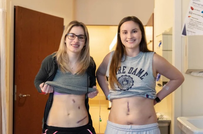 Siostry Goralski z Illinois oddały nerki nieznajomym, żeby uhonorować zmarłego ojca 