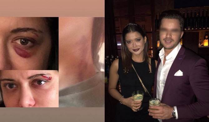 Miriam Shaded ostrzega przed swoim byłym chłopakiem, pokazuje zdjęcia z pobicia