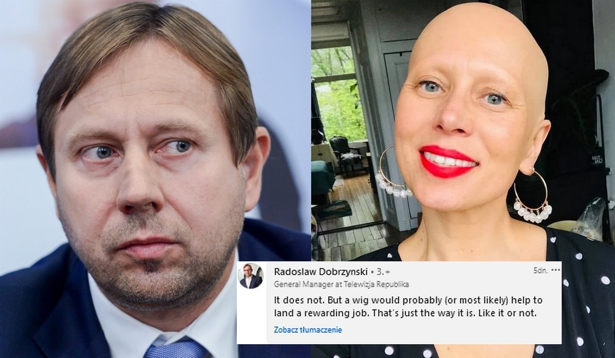 Dyrektor TV Republika napisał do chorej kobiety, żeby zaczęła nosić perukę, bo jak jest łysa to trudniej znaleźć pracę
