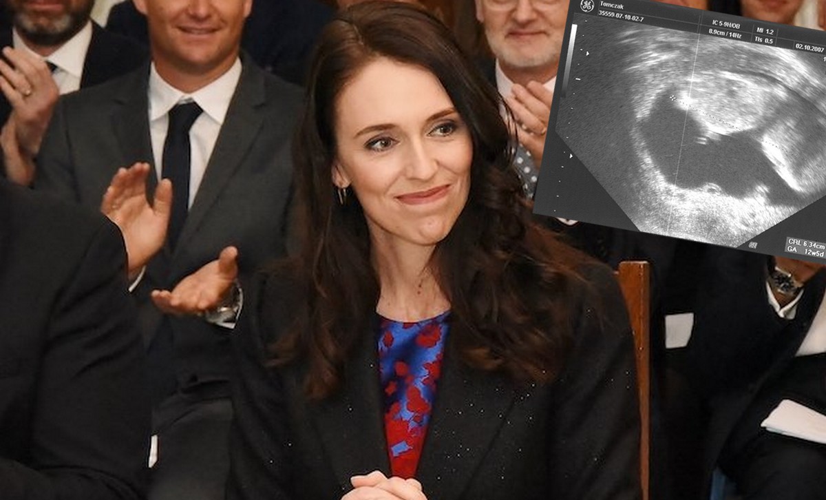 Nowa Zelandia wprowadza płatny urlop po poronieniu, bo o dziwo nie jest to międzynarodowy standard