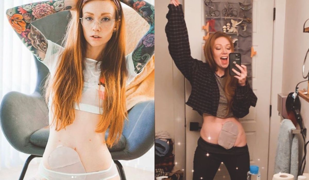 Gwiazda OnlyFans zyskała na popularności, bo jej niepełnosprawność okazała się dla odbiorców pociągająca