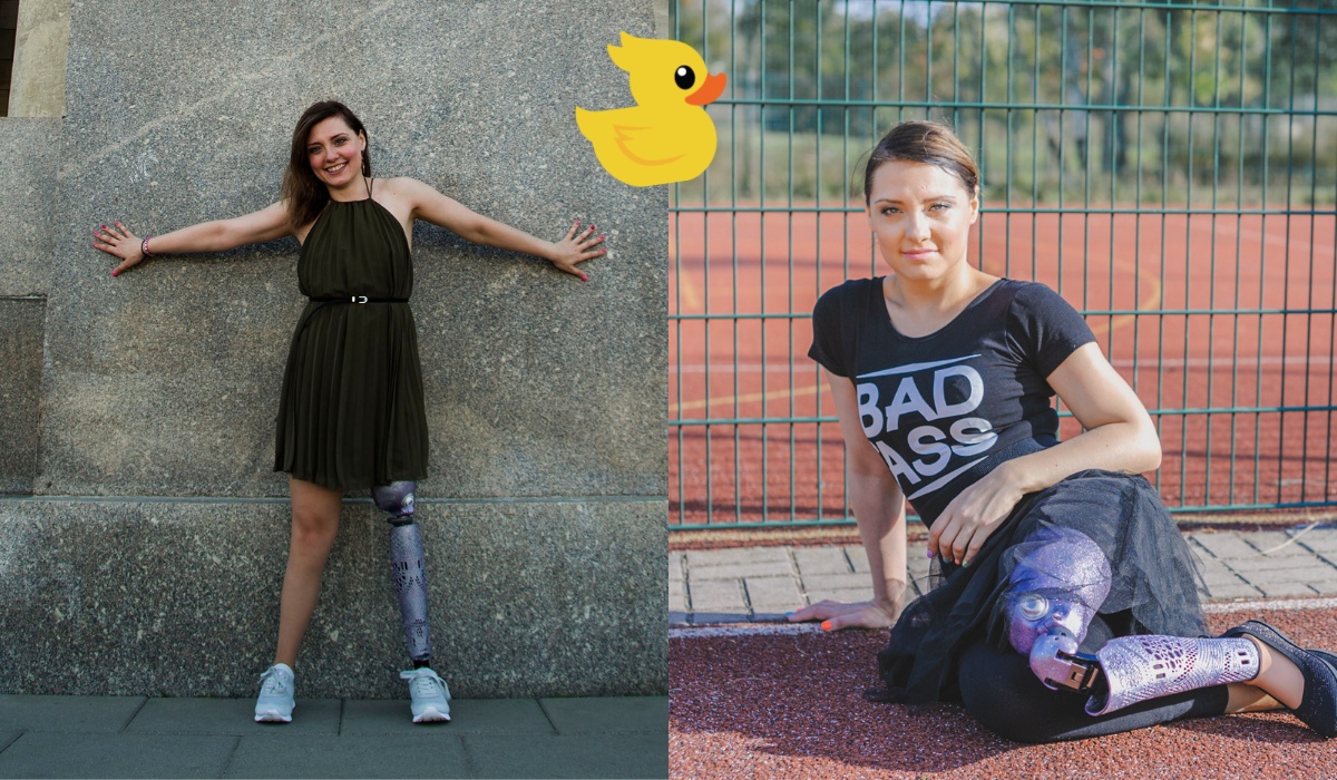 Rozmawiamy z Dziewczyną z Fioletową Nogą o tym, dlaczego ma fioletową nogę i czy jest influencerką