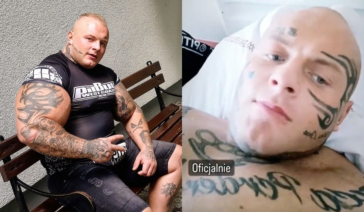 Szymon Komandos, znany jako polski Król Syntholu, musiał przejść operację bicepsów