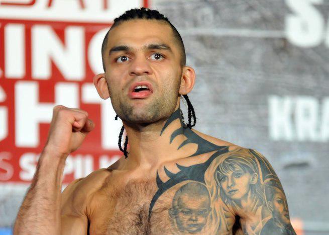 Prokuratura w sprawie Kosteckiego: biegli wykluczyli, że są to ślady powstałe na skutek ukłucia