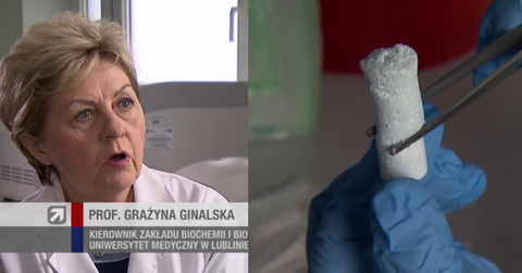 Lublin: eksperymentalny wszczep sztucznej kości zakończony sukcesem