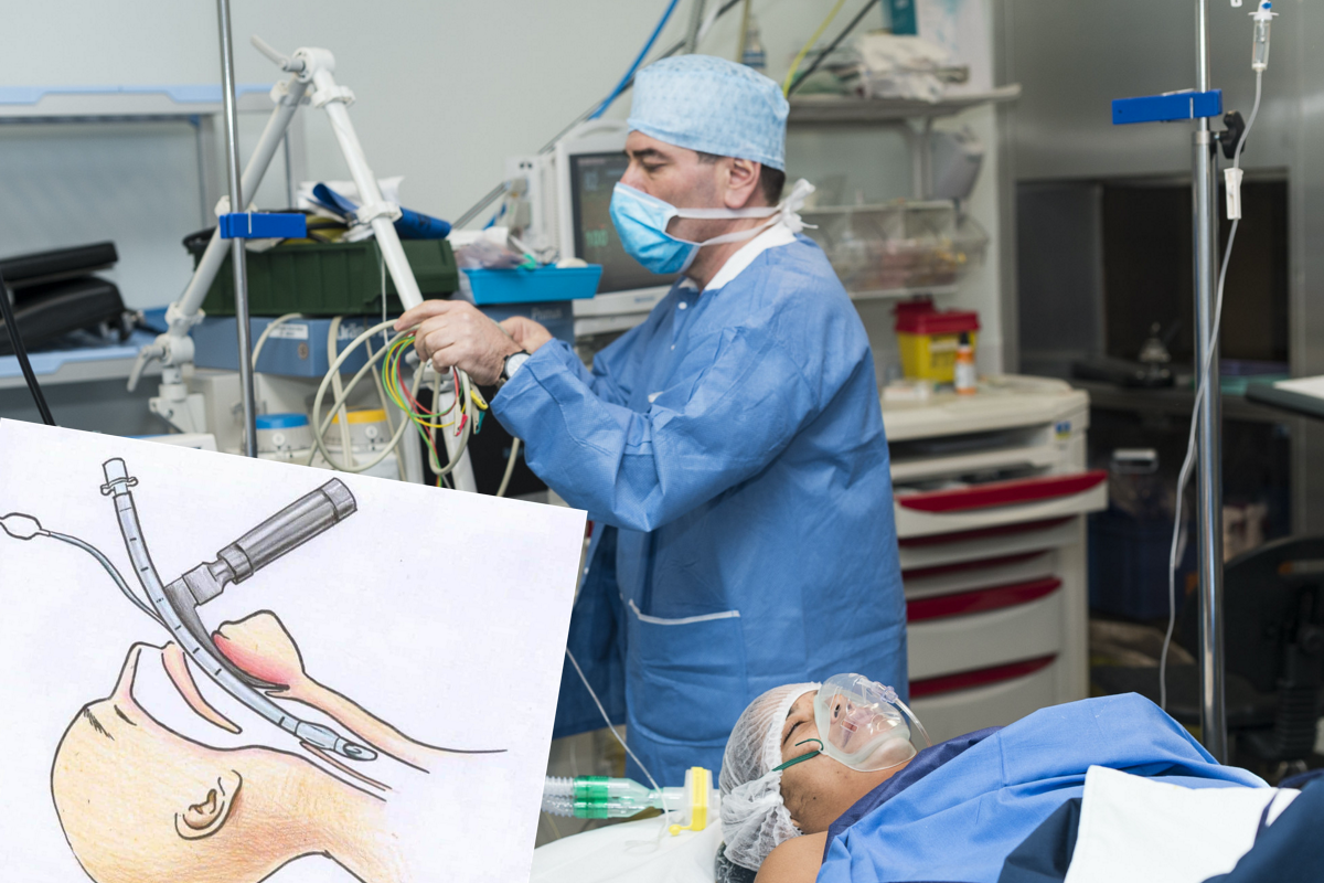 Respirator to nie jest maska tlenowa: zobacz, co oznacza "bycie podłączonym"