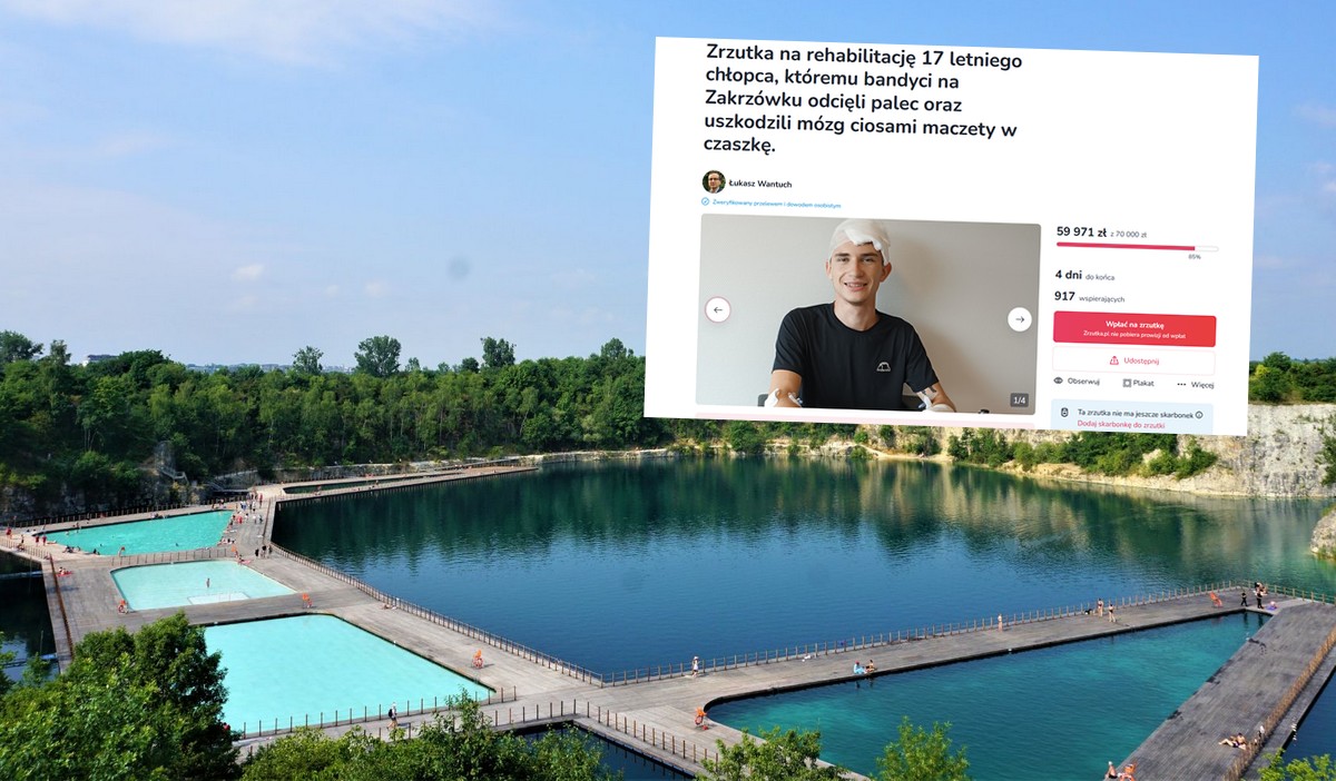 Kraków: zbiórka na ukraińskiego chłopaka pobitego przez bandytów udała się na 89%