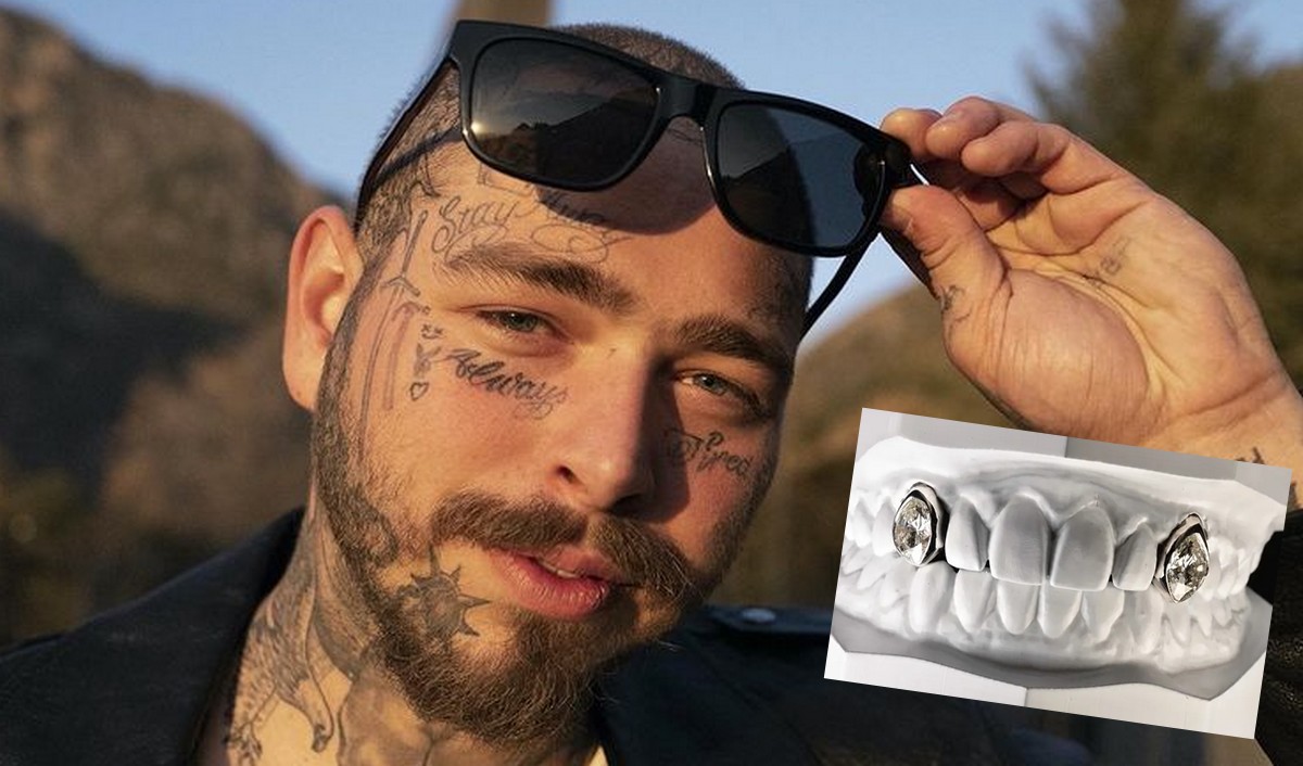 Post Malone postanowił mieć uśmiech za milion dolarów i wstawił sobie dwa diamentowe zęby