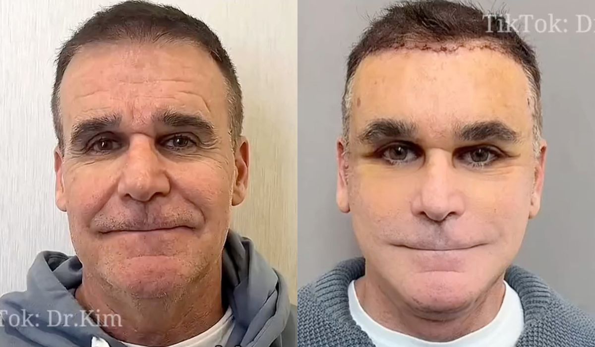 Operacje plastyczne koreańskiego lekarza stały się sławne, ale nie tak, jak chciał
