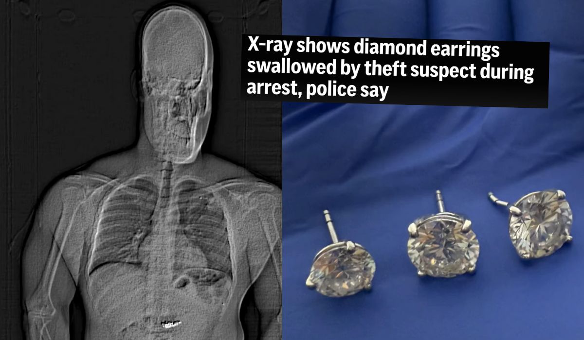 USA: policja złapała złodzieja, który połknął drogie kolczyki, trzeba było czekać, aż z niego wyjdą