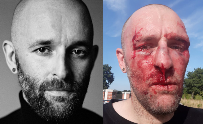 Dziennikarz pobity we Wrocławiu. "Zwróciłem uwagę na homofobiczne napisy"