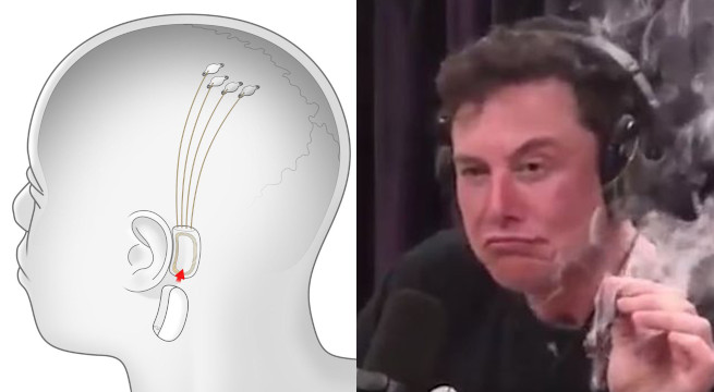 Elon Musk przekonuje: streaming muzyki prosto do mózgu już niedługo