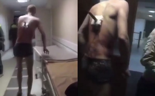 Rosja: ranny z nożem w plecach wymknął się na papieroska