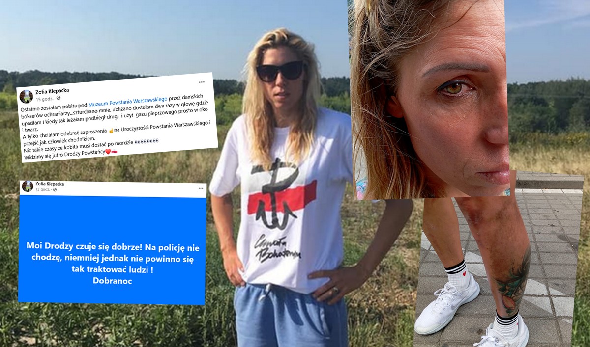 Muzeum Powstania Warszawskiego odpowiada Zofii Klepackiej, która twierdzi, że została pobita przez ich ochronę